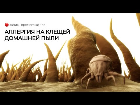 Видео: Запись прямого эфира «Аллергия на клещей домашней пыли»