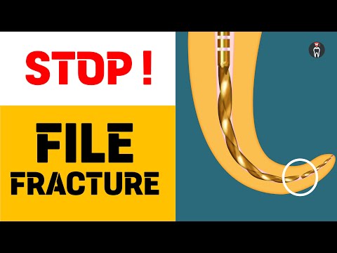 Видео: Остановить перелом файла