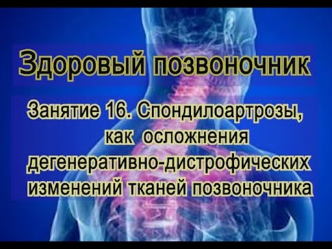 Видео: Занятие 16.   Спондилоартроз в больном позвоночнике при ДДИ.