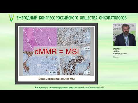 Видео: Рак эндометрия - значение определения микросателлитной нестабильности и PD-L1