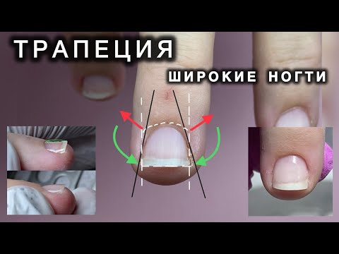 Видео: ШИРОКИЕ, КОРОТКИЕ, ВЗЛЕТНЫЕ, НОГТИ ТРАПЕЦИЯ #вверхрастущиеногти #ногтитрапеция #взлетныеногти #nails