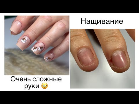 Видео: Наращивание на проблемные ногти