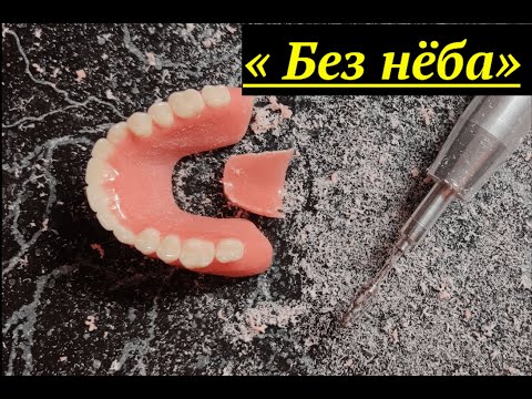 Видео: Съёмные БЕЗ нёба существуют? #стоматология #протезированиезубов