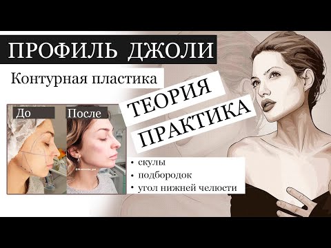 Видео: ПРОФИЛЬ ДЖОЛИ теория и практика / схемы СКУЛЫ, ПОДБОРОДОК, УГОЛ НИЖНЕЙ ЧЕЛЮСТИ.