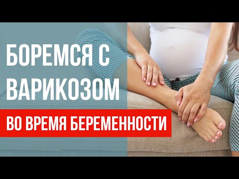 Видео: Варикоз ног у беременных: причины, профилактика, лечение. Как избавиться от варикоза?