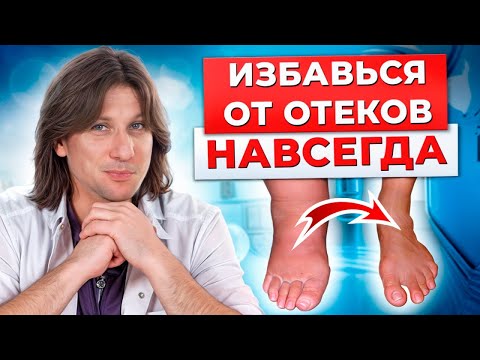 Видео: СТРАШНЫЕ последствия ОТЕКОВ! Эти эффективные упражнения избавят от ОТЕКОВ