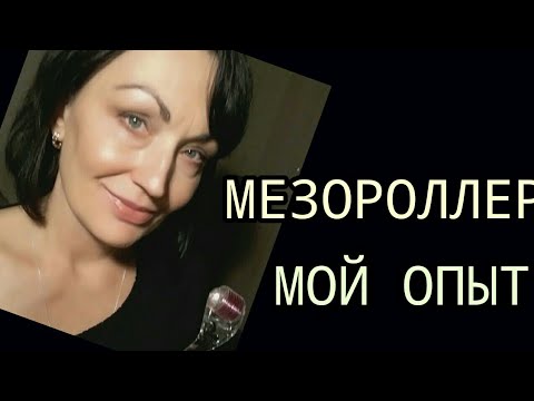 Видео: Мезороллер в домашних условиях // Мой опыт применения.