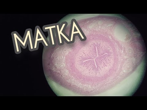 Видео: МАТКА