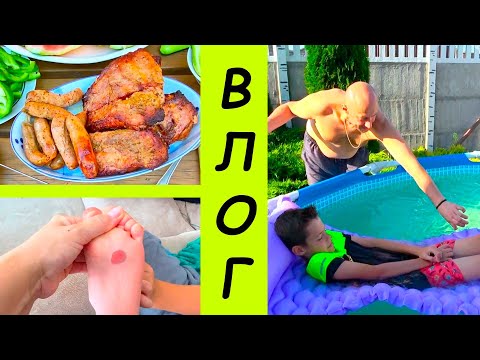 Видео: УКУСИЛА ПЧЕЛА( Как СНИМАЕМ. ВЛОГ.