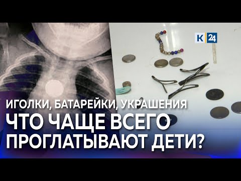 Видео: Что делать, если ребенок проглотил инородный предмет? Иглы, магниты и батарейки в детских желудках