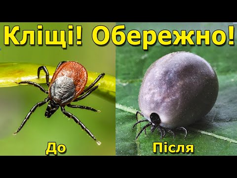 Видео: Кліщі - маленькі паразити. Що буде, якщо вкусить кліщ? Цікаві факти про кліщів.