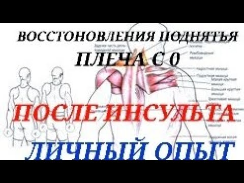 Видео: ВОССТОНОВЛЕНИЯ ПОДНЯТЬЯ ПЛЕЧА ПОМЛЕ ИНСУЛЬТА , ЛЛИЧНЫЙ ОПЫТ РЕАБИЛИТАЦИИ