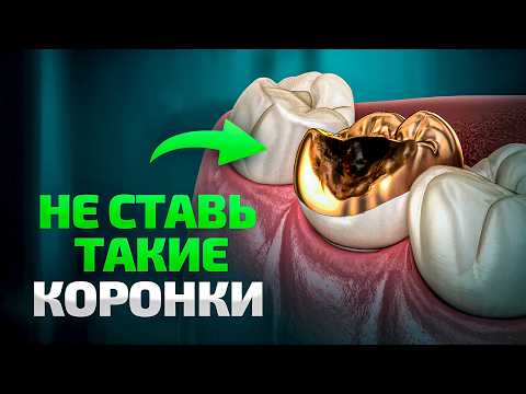 Видео: Какие КОРОНКИ выбрать в 2025 году? Подробный гайд от главного ортопеда