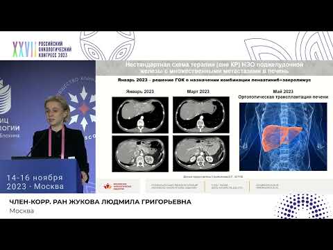 Видео: Опыт работы Городского онкологического консилиума