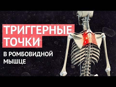 Видео: Поиск и коррекция триггерных точек в ромбовидной мышце