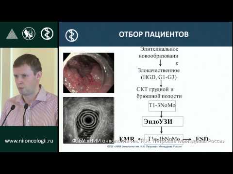 Видео: Эндоскопическое лечение раннего рака желудка
