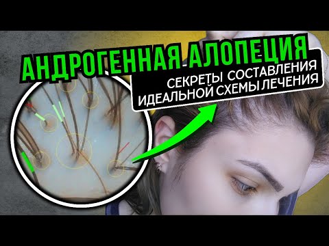 Видео: Андрогенная алопеция |ТЕОРИЯ И ЛОГИКА СОСТАВЛЕНИЯ ЛЕЧЕНИЯ| всё, что нужно знать!