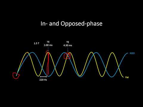 Видео: МР-физика 3 — Подавление жира