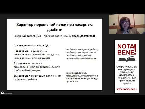 Видео: 20.03.2021. Бебнева Т.Н. Зуд вульвы. Конференция NOTA BENE!