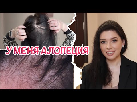 Видео: Я ЛЫСЕЮ. Уход при АГА! Миноксидил. Ценные советы. Генетика и наследственность. Облысение у женщин