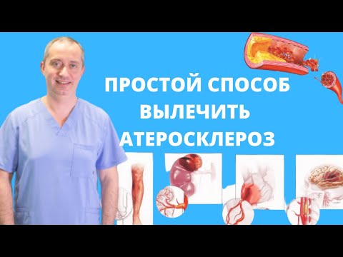 Видео: Как вылечить атеросклероз?