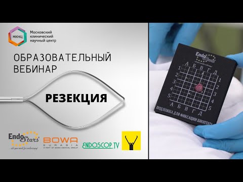Видео: Запись трансляции из МКНЦ 15.06. Клинический случай №5: эндоскопическая резекция