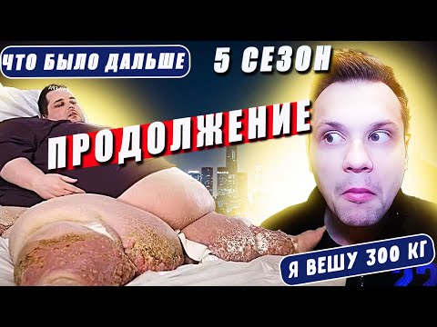 Видео: Я вешу 300 кг Что было дальше 5 сезон История Джеймса Кинга ✌👍😉