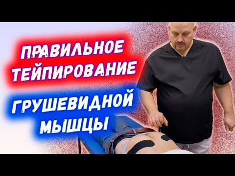 Видео: Тейпирование грушевидной мышцы при спазме | Кинезиотейпирование при синдроме грушевидной мышцы