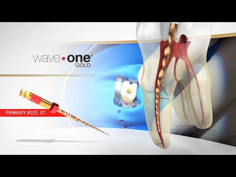 Видео: Реципрокные файлы WAVEONE GOLD в комбинации с файлом для ковровой дорожки  PROGLIDER от Maillefer