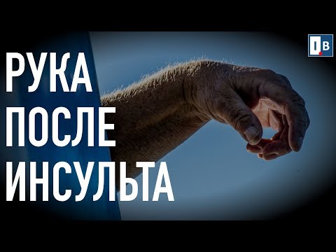Видео: УПРАЖНЕНИЕ ДЛЯ ПАРАЛИЗОВАННОЙ РУКИ. С него начинается первое движение.