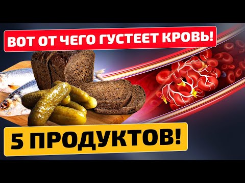 Видео: Неочевидные признаки густой крови и причины!