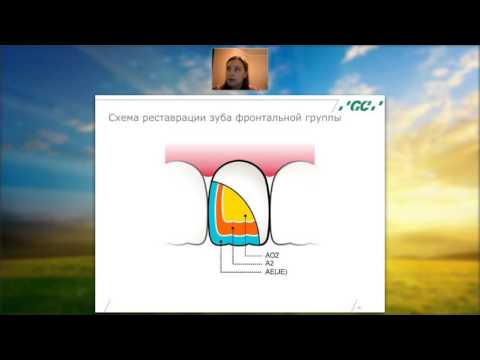 Видео: Вебинар "Реставрация фронтальной группы зубов" (19/04/16)