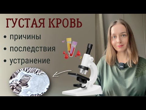 Видео: Слипшиеся эритроциты, сгущение крови - от чего и чем грозит ?