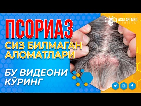 Видео: ПСОРИАЗнинг  СИЗ БИЛМАГАН АЛОМАТЛАРИ. ВИДЕО КЎРИНГ. #saidatabiba  #asalarimed #psoriasis