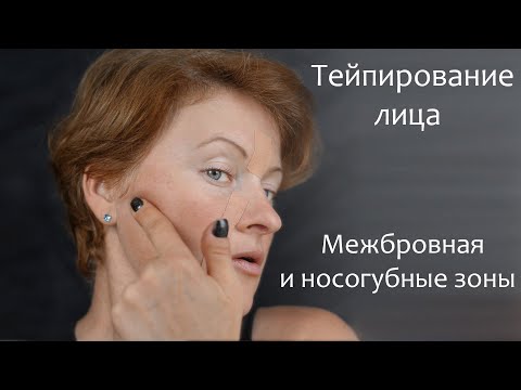 Видео: Тейпирование лица. Межбровная и носогубные зоны.