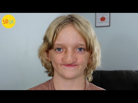 Видео: Самый редкий подросток в мире