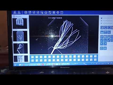 Видео: Визиограф из Китая.