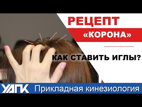Видео: Гармонизация с помощью игл (Е.Чижикова)