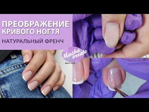 Видео: Преображение деформированного ногтя. Натуральный френч на ногтях. Ремонт ногтей.