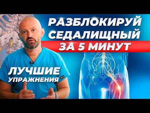 Видео: Защемило СЕДАЛИЩНЫЙ НЕРВ: Срочно делайте упражнения дома