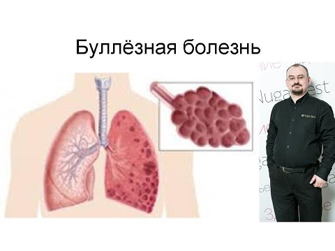 Видео: Буллёзная болезнь