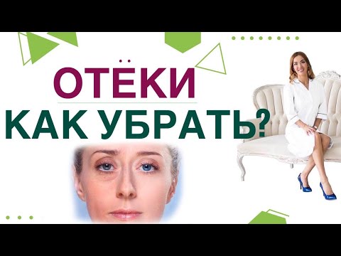 Видео: 💊 ОТЕКИ. КАК УБРАТЬ ОТЕКИ И СНИЗИТЬ ВЕС? ПРИЧИНЫ ОТЕКОВ, ЛЕЧЕНИЕ. Врач эндокринолог Ольга Павлова.