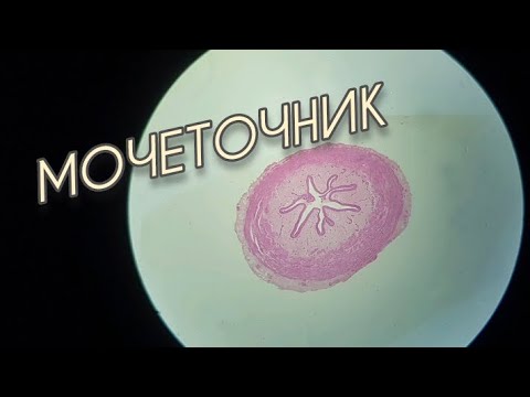 Видео: МОЧЕТОЧНИК
