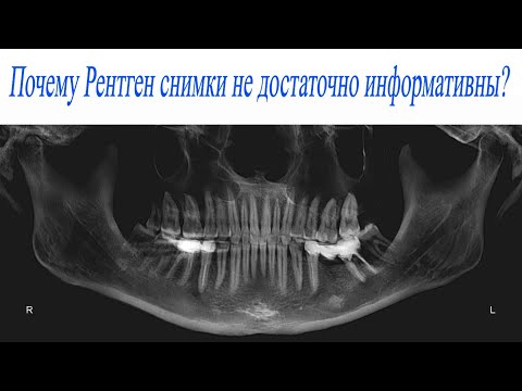 Видео: #ОПТГ или #КЛКТ (#КТ)