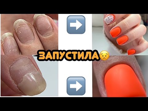 Видео: Ппц ногтям спустя 2 месяца 😬 Как из ничего сделать квадрат / Лайфхаки для маникюра