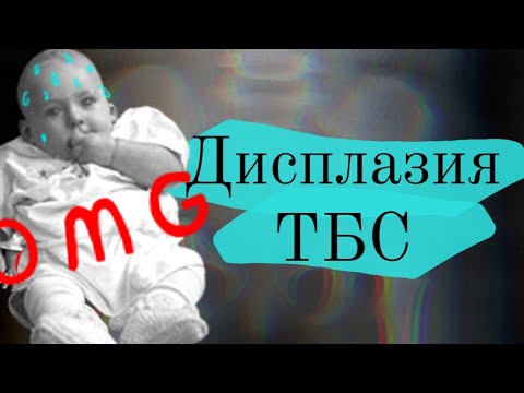 Видео: Дисплазия тазобедренного сустава: рентген👶