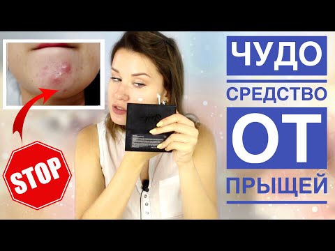Видео: КОПЕЕЧНОЕ ЧУДО СРЕДСТВО ОТ ПРЫЩЕЙ