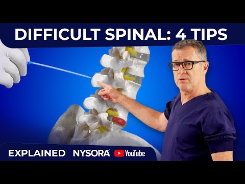 Видео: Что делать, если игла во время спинномозговой или люмбальной пункции упирается в кость?