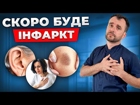 Видео: ПЕРШІ ОЗНАКИ ІНФАРКТУ! Ранні симптоми, які ви не помічаєте