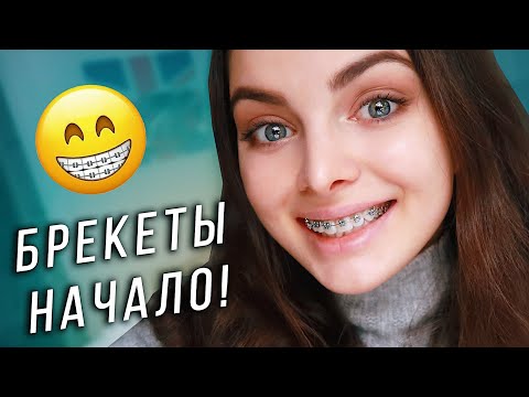 Видео: ПОСТАВИЛА БРЕКЕТЫ! Первые ощущения и боль! 😬😱